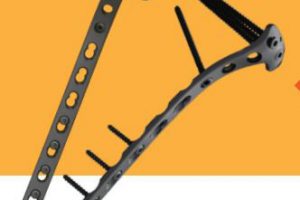 PLACA LOC DE TIBIA PROXIMAL LATERAL AV 5.0 MM